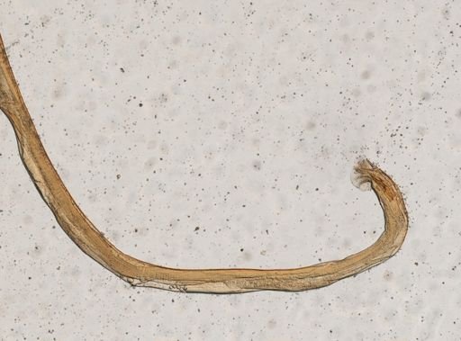 Oswaldocruzia pipiens