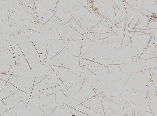 Desmacella infundibuliformis