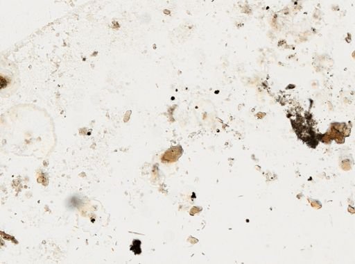 Paragonimus westermani