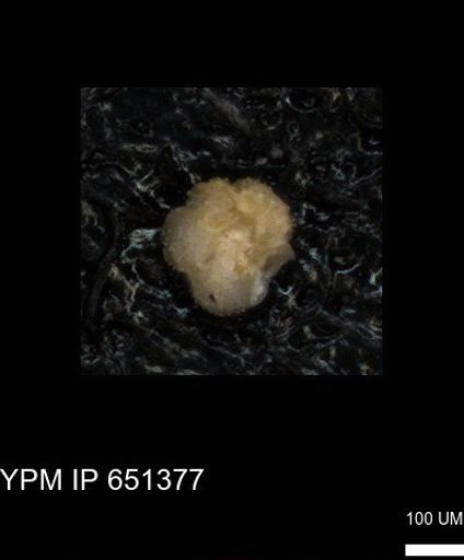 undet. Foraminiferida