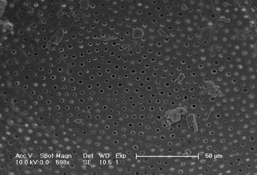 Globorotalia menardii
