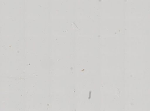 Paramecium polycaryum