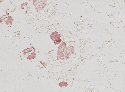 Distomum