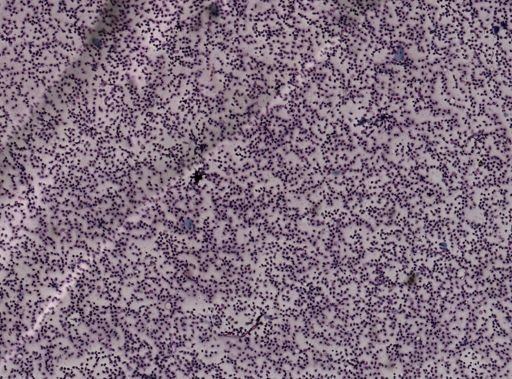 Trypanosoma?