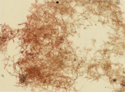 Chalinula loosanoffi
