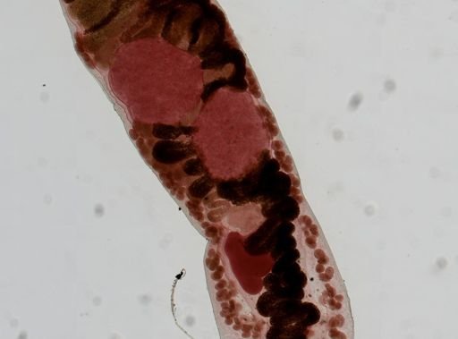 Haematoloechus medioplexus