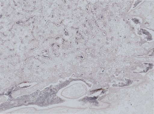 Ostrea?