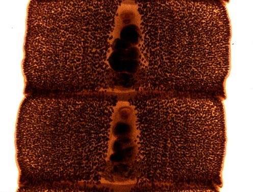 Diphyllobothrium erinacei