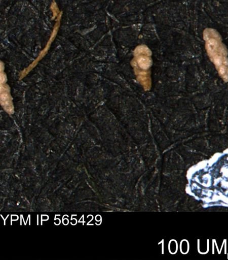 Verneuilina canadensis