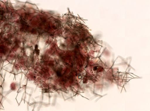 Haliclonidae