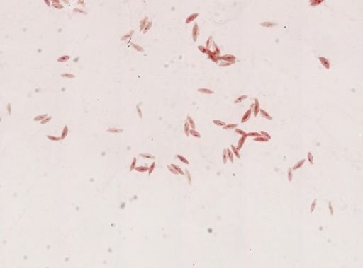 Paramecium caudatum