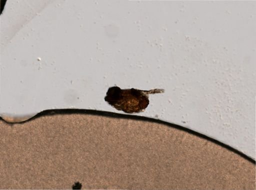 Rotifera
