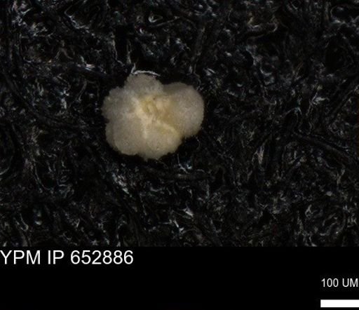 undet. Rugoglobigerinidae