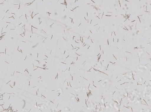 Hymedesmia sp.