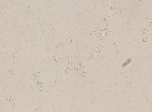 Enterobius vermicularis