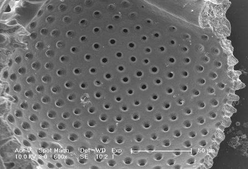 Globigerinoides sacculifer