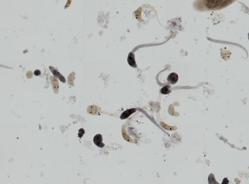 Cryptocotyle lingua