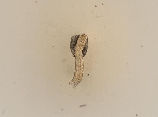 Campeloma decisum