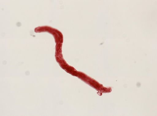 Digenea