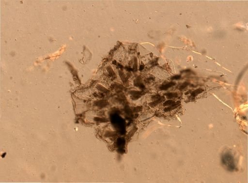 Bryozoa