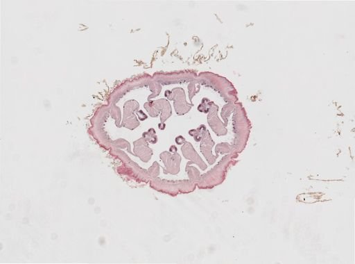 Edwardsia sp.