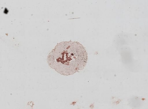 Plasmodium vivax