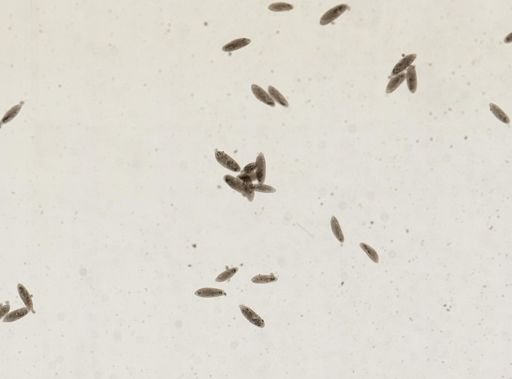 Paramecium caudatum