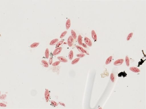 Paramecium calkinsi