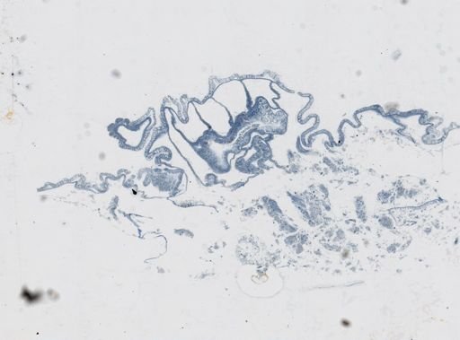 Astrangia poculata