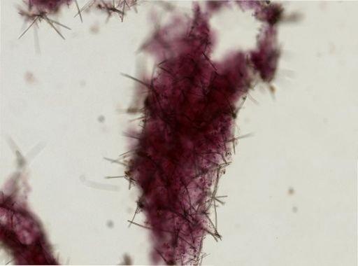 Ectyoplasia ferox