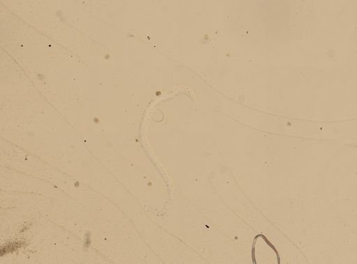 Trichinella spiralis