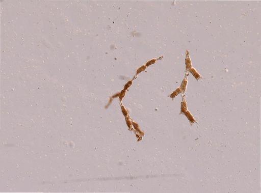 Bryozoa
