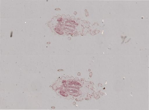 Rhopalosiphum nymphaeae