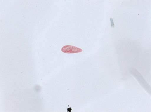 Paramecium aurelia