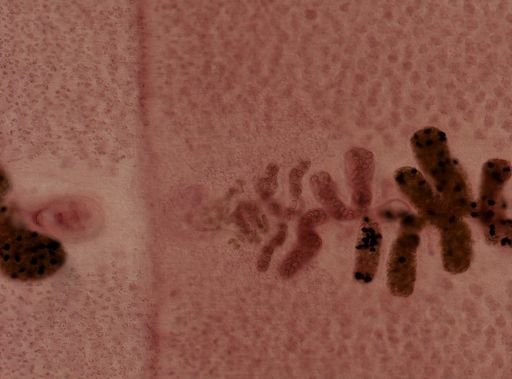 Diphyllobothrium latum