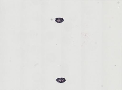 Plagiostomum stellatum