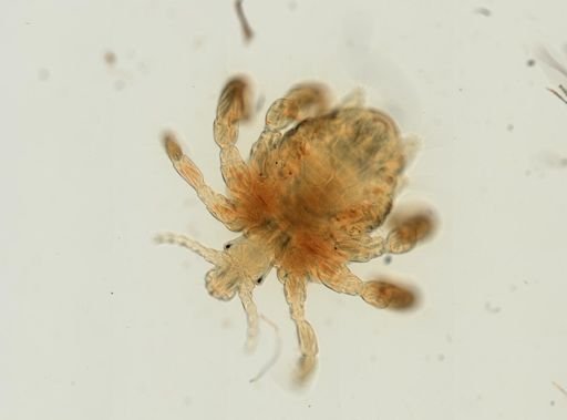 Pthirus pubis