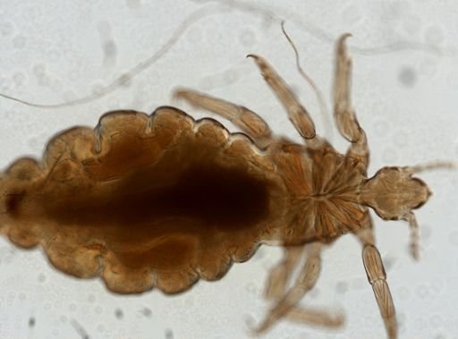 Pediculus humanus