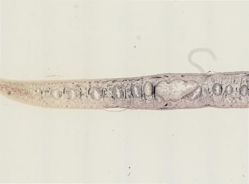 Turbellaria
