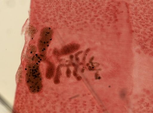 Diphyllobothrium latum