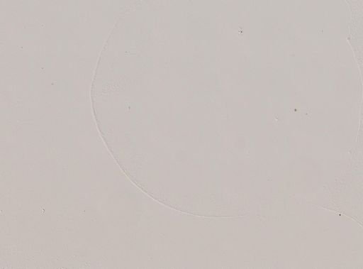 Streptobacillus