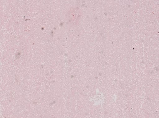 Plasmodium