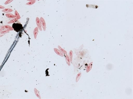 Paramecium aurelia