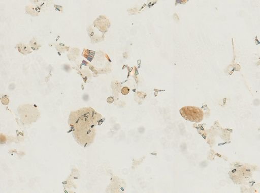 Ascaris lumbricoides