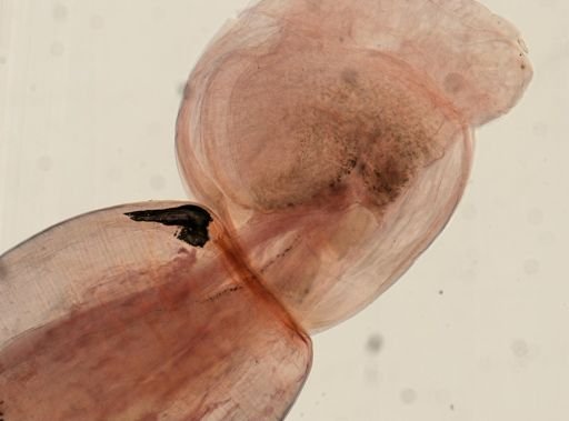 Oligacanthorhynchus microcephalus