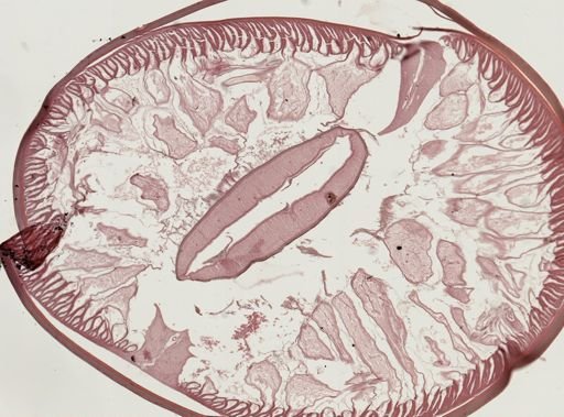 Ascaris lumbricoides