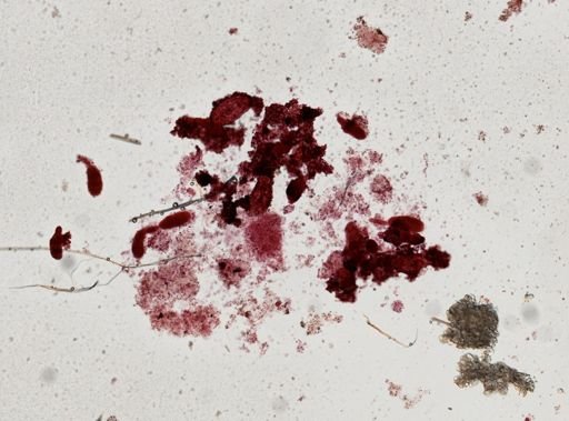 Fasciola hepatica