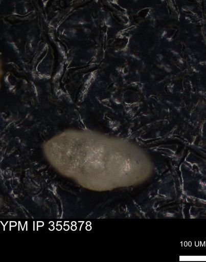 undet. Foraminiferida