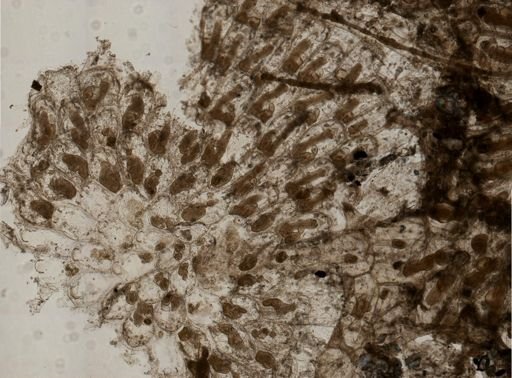 Alcyonidium