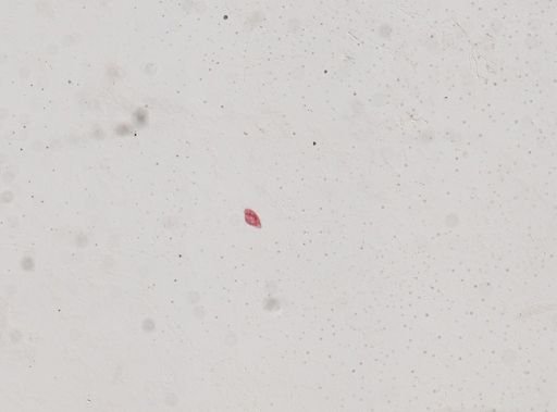 Oxytricha